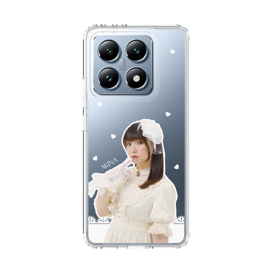 Slim Protection Case［ Akina Homoto - Lace ］