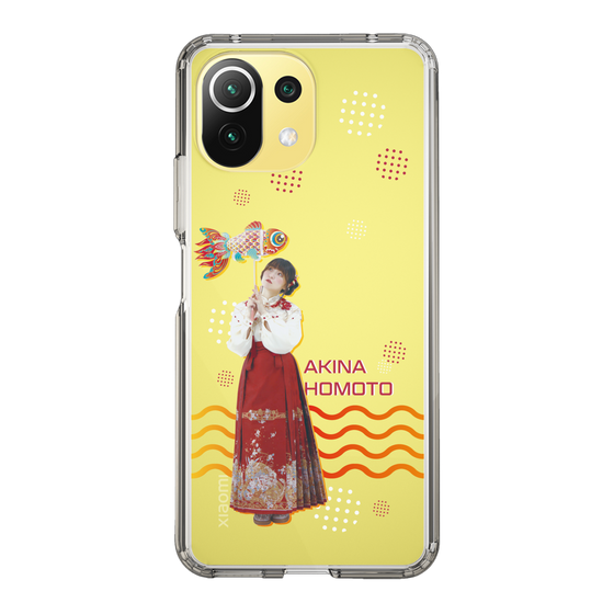 Slim Protection Case［ Akina Homoto - Goldfish ］