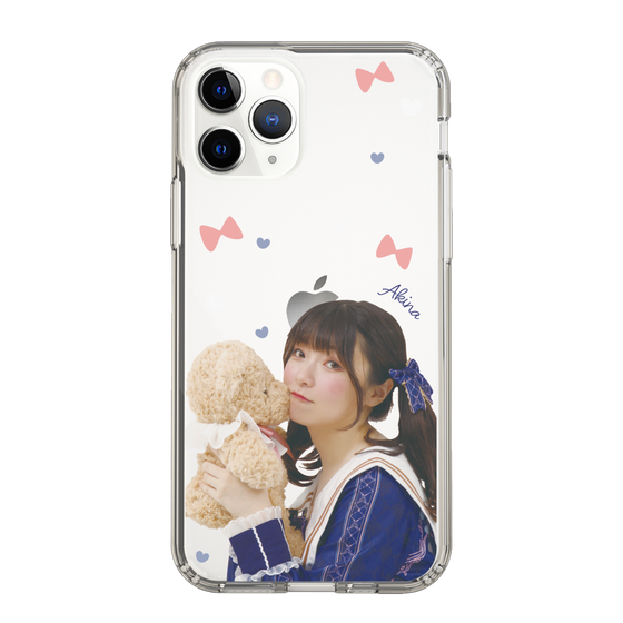 Slim Protection Case［ Akina Homoto - Teddy Bear ］
