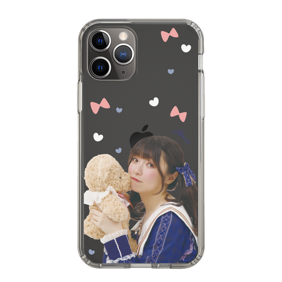Slim Protection Case［ Akina Homoto - Teddy Bear ］