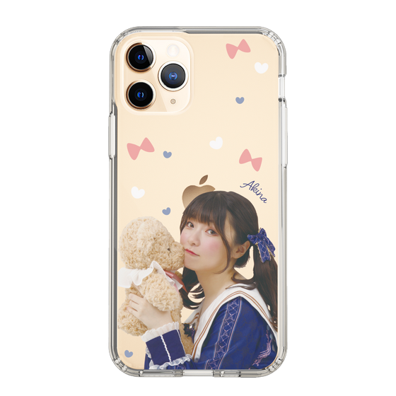 Slim Protection Case［ Akina Homoto - Teddy Bear ］