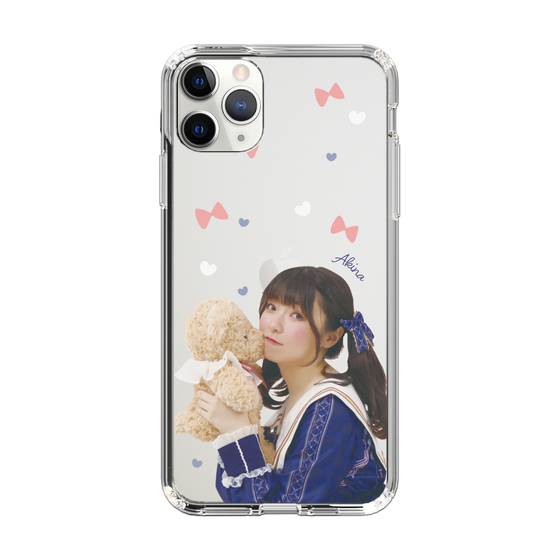 Slim Protection Case［ Akina Homoto - Teddy Bear ］