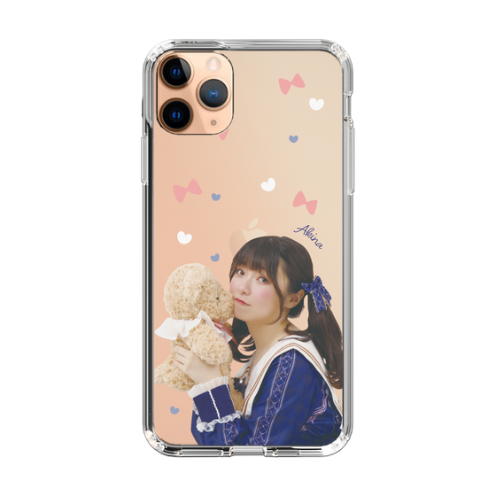 Slim Protection Case［ Akina Homoto - Teddy Bear ］