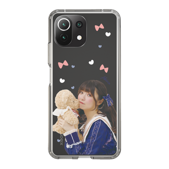 Slim Protection Case［ Akina Homoto - Teddy Bear ］