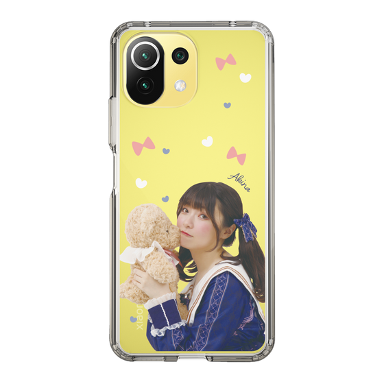 Slim Protection Case［ Akina Homoto - Teddy Bear ］