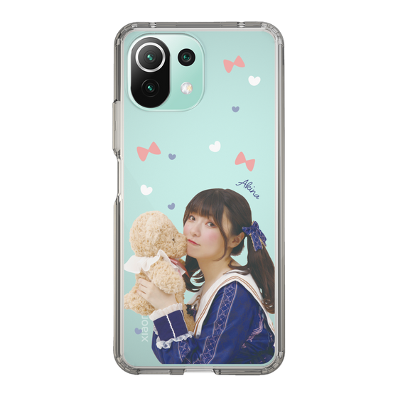 Slim Protection Case［ Akina Homoto - Teddy Bear ］