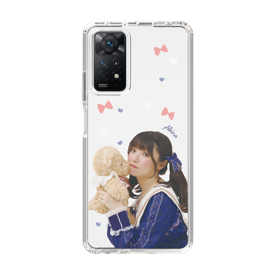 Slim Protection Case［ Akina Homoto - Teddy Bear ］