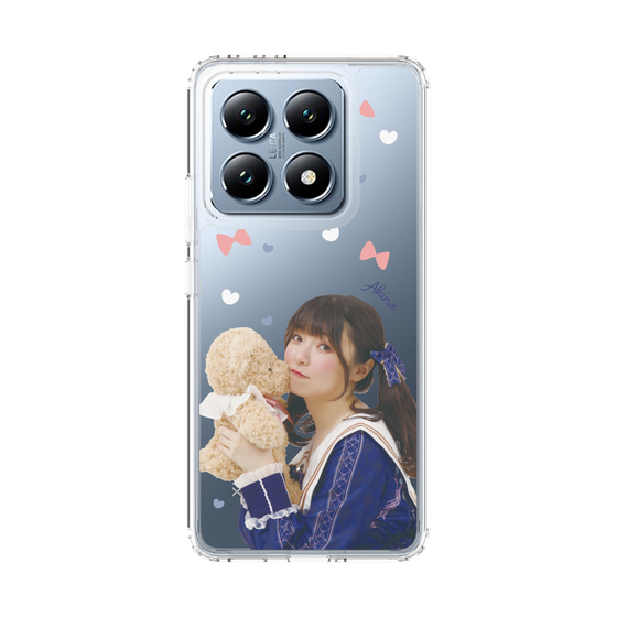 Slim Protection Case［ Akina Homoto - Teddy Bear ］