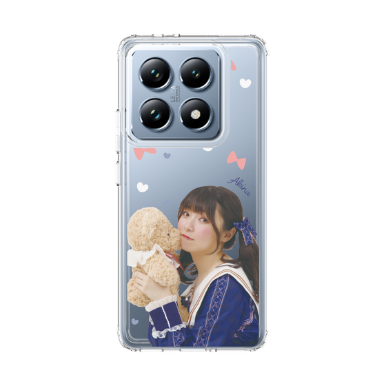 Slim Protection Case［ Akina Homoto - Teddy Bear ］