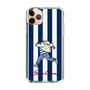 Slim Protection Case［ SINA COVA - Stripe ］