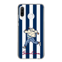 Slim Protection Case［ SINA COVA - Stripe ］