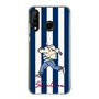 Slim Protection Case［ SINA COVA - Stripe ］