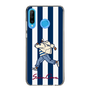 Slim Protection Case［ SINA COVA - Stripe ］