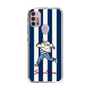 Slim Protection Case［ SINA COVA - Stripe ］