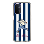 Slim Protection Case［ SINA COVA - Stripe ］