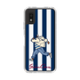 Slim Protection Case［ SINA COVA - Stripe ］