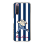 Slim Protection Case［ SINA COVA - Stripe ］
