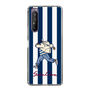 Slim Protection Case［ SINA COVA - Stripe ］