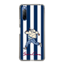 Slim Protection Case［ SINA COVA - Stripe ］