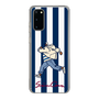 Slim Protection Case［ SINA COVA - Stripe ］