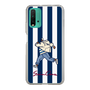 Slim Protection Case［ SINA COVA - Stripe ］