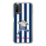 Slim Protection Case［ SINA COVA - Stripe ］