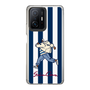 Slim Protection Case［ SINA COVA - Stripe ］