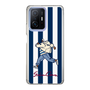 Slim Protection Case［ SINA COVA - Stripe ］