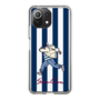 Slim Protection Case［ SINA COVA - Stripe ］