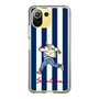 Slim Protection Case［ SINA COVA - Stripe ］