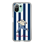 Slim Protection Case［ SINA COVA - Stripe ］