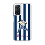 Slim Protection Case［ SINA COVA - Stripe ］