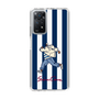 Slim Protection Case［ SINA COVA - Stripe ］