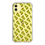 Slim Protection Case［ ROMANs - GambaRoman Pattern ］